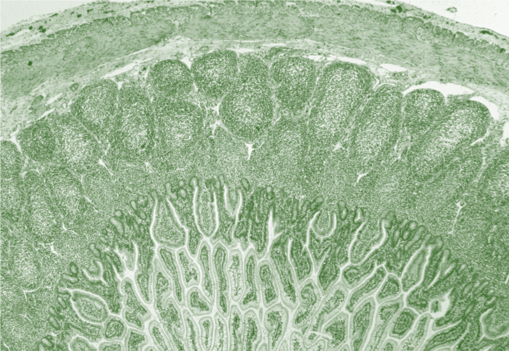 GALT includes oval masses of lymphatic tissue called Peyer's Patches (shown above). 