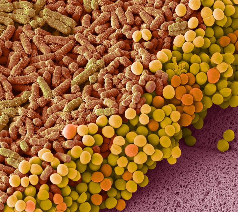 Colored scanning electron micrograph of rod-shaped and spherical bacteria on tissue surface