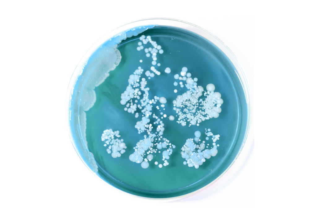 Petri dish with blue agar medium and white bacterial colonies growing on the surface