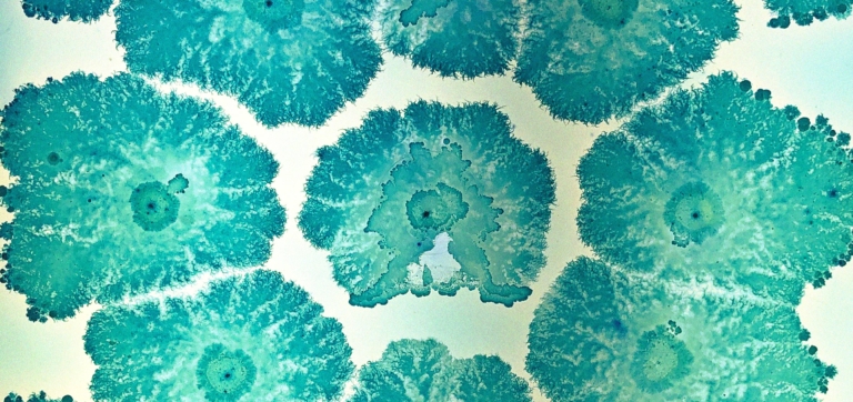 Blue-green circular mold colonies growing on a white surface.