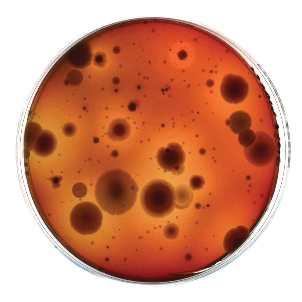 Petri dish with bacterial colonies growing on an agar medium.