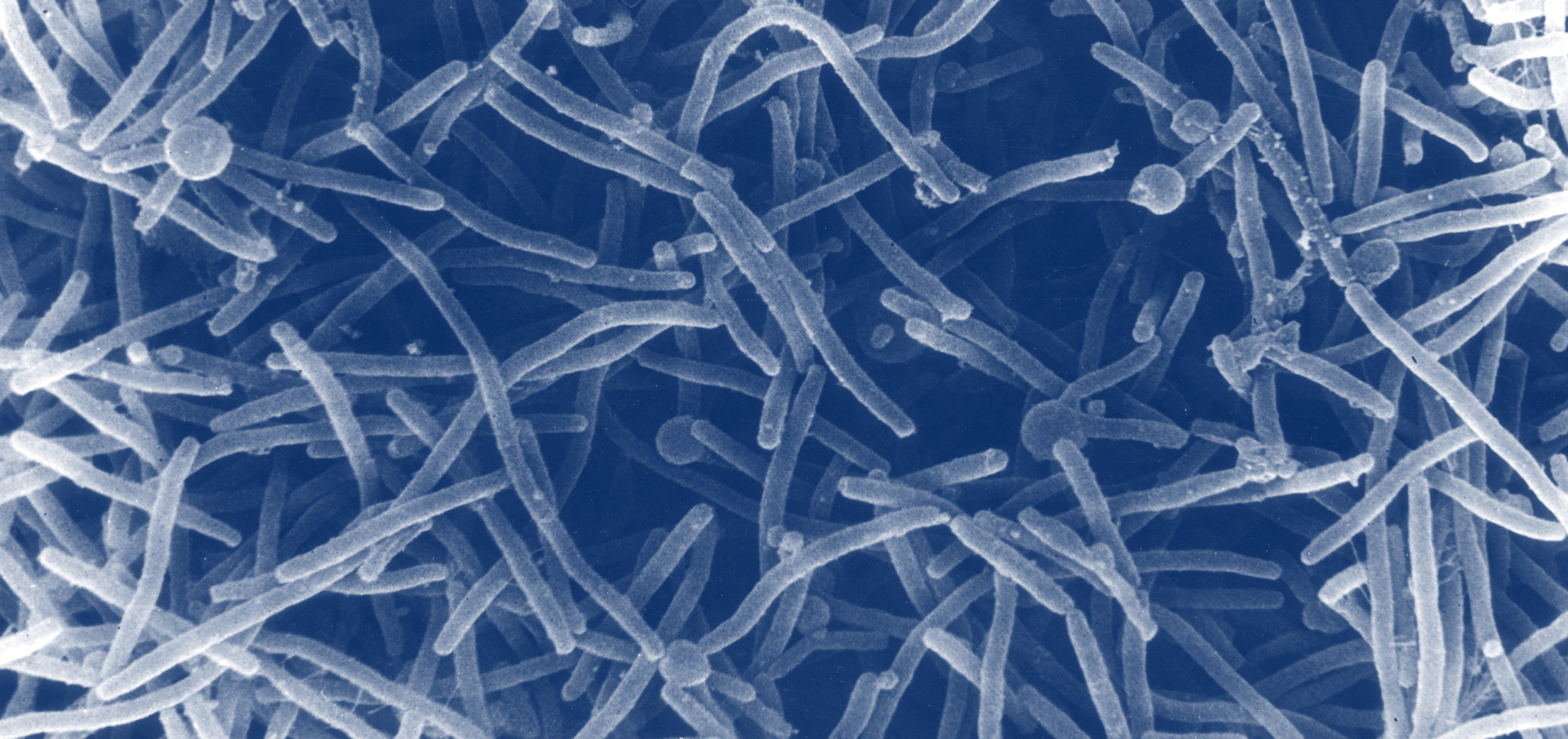 Microscopic view of rod-shaped bacteria with spherical end structures on a blue background.