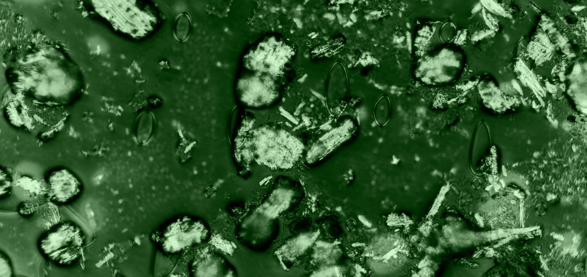 Microscopic view of irregularly shaped particles and bubbles in a green-tinted fluid.