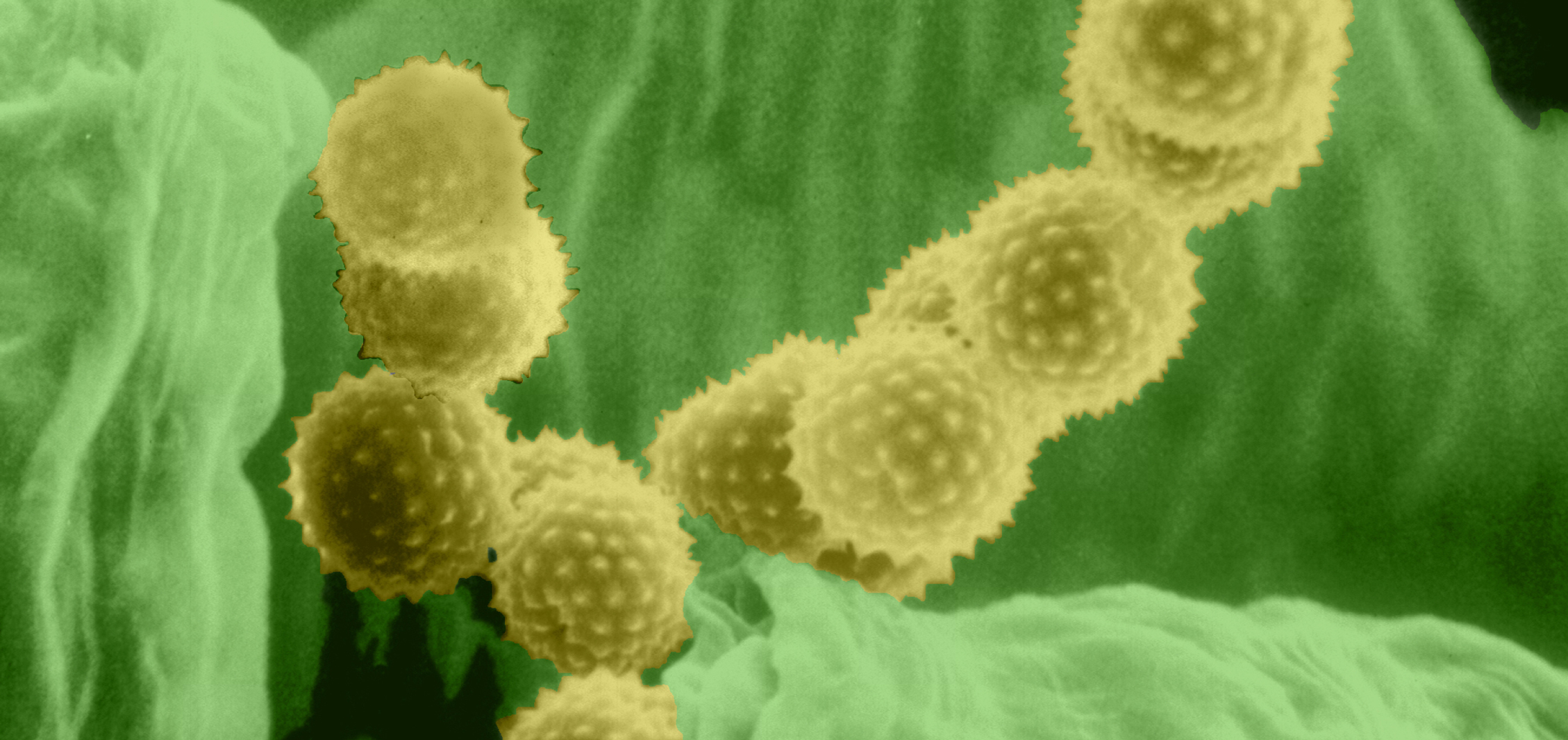 How to Get Your Microbiome Ready for Allergy Season