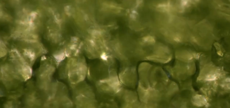 Can Probiotics Help With a “Leaky Gut”? 