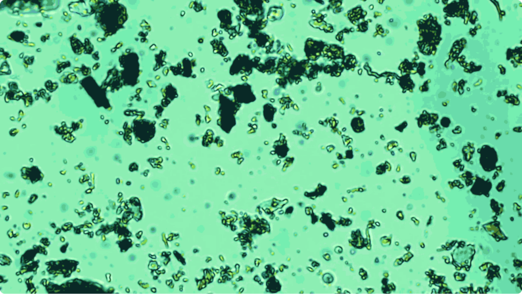 Assorted farm soil bacteria sample teeming with life, as seen under a microscope (800x magnification).
