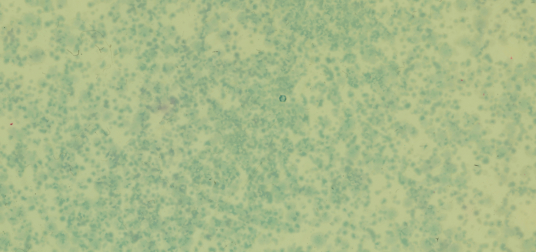 Probiotics, Explained: The Science Behind Your Gut’s Favorite Microbes