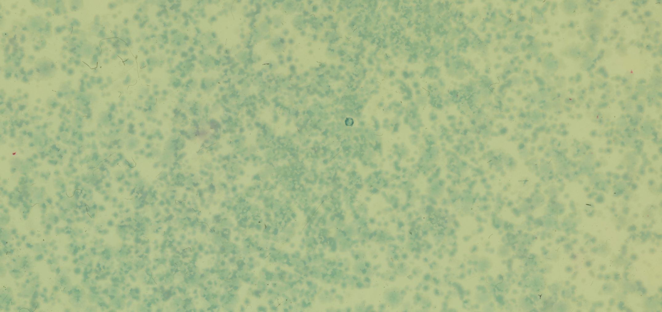 Probiotics, Explained: The Science Behind Your Gut’s Favorite Microbes