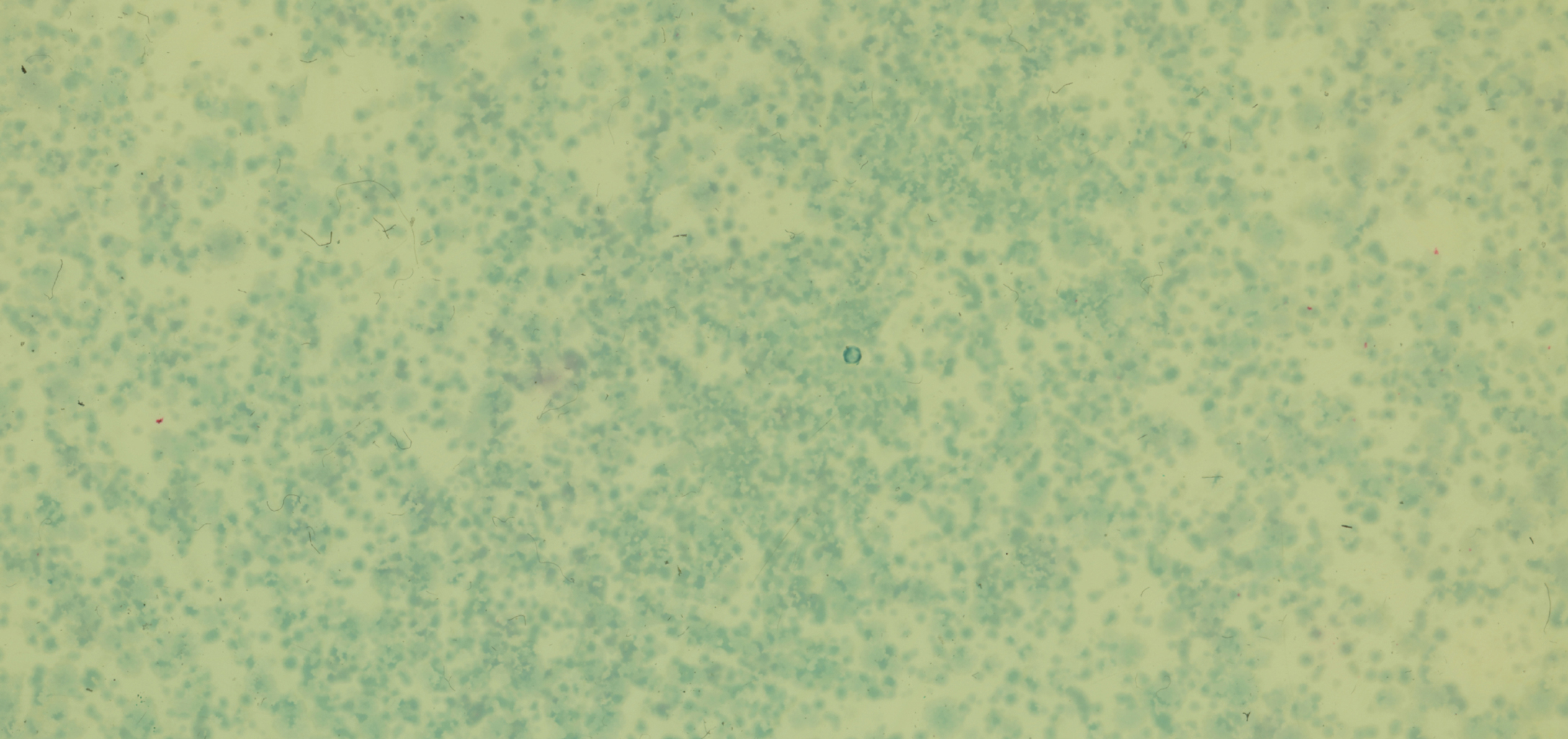 Lactobacillus crispatus: Your Vagina’s Microscopic Bodyguard