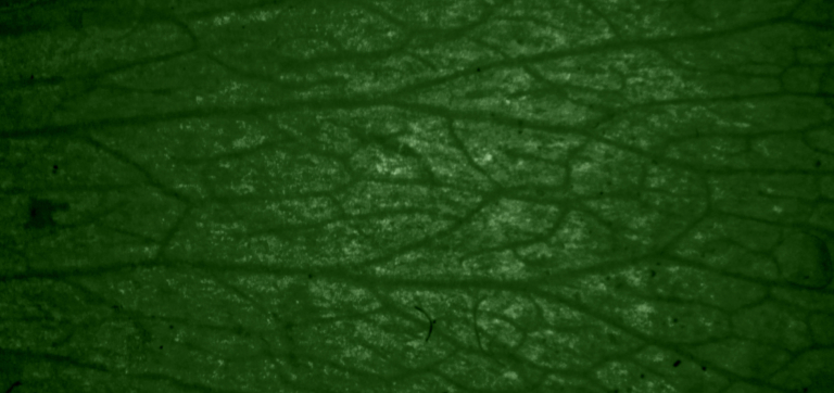 Lacticaseibacillus casei Decoded—Strains, Studies, and Practical Guidance