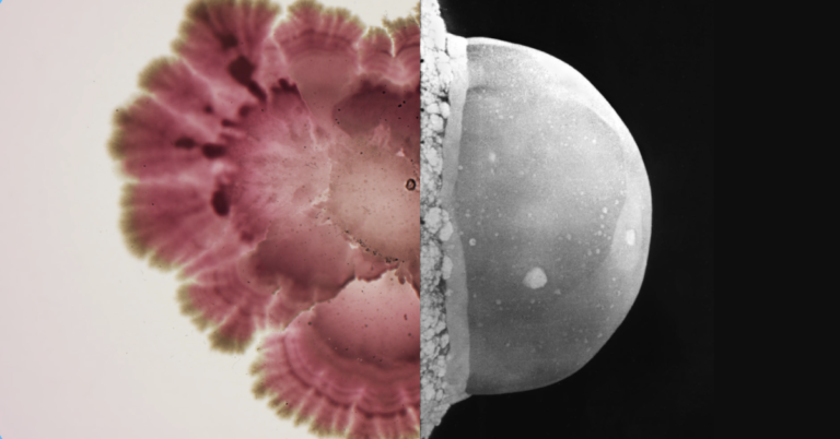 We Waged A 100 Year War Against Bacteria Now We Need Their help