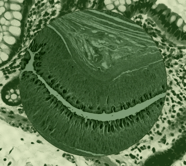 Microscopic cross-section of tissue with cellular structures and layered patterns in green tones.