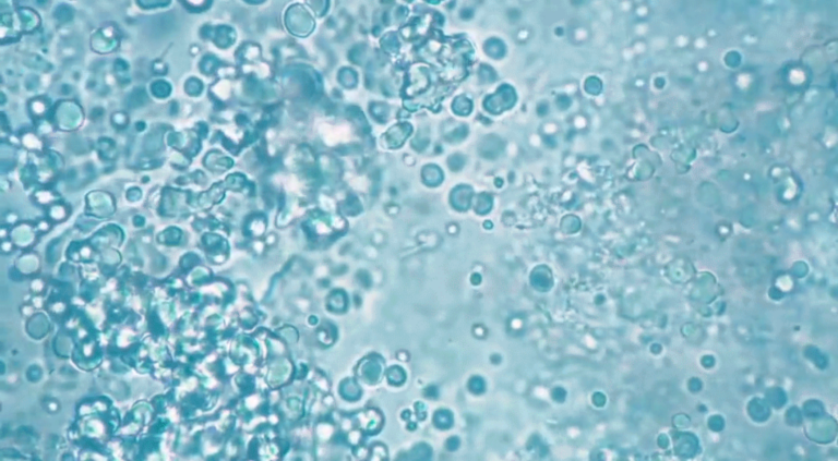 Lactobacillus bacteria at 1000x magnification.