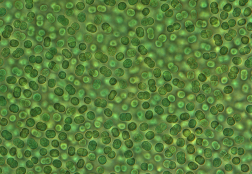 Microscopic view of green algae cells clustered together.