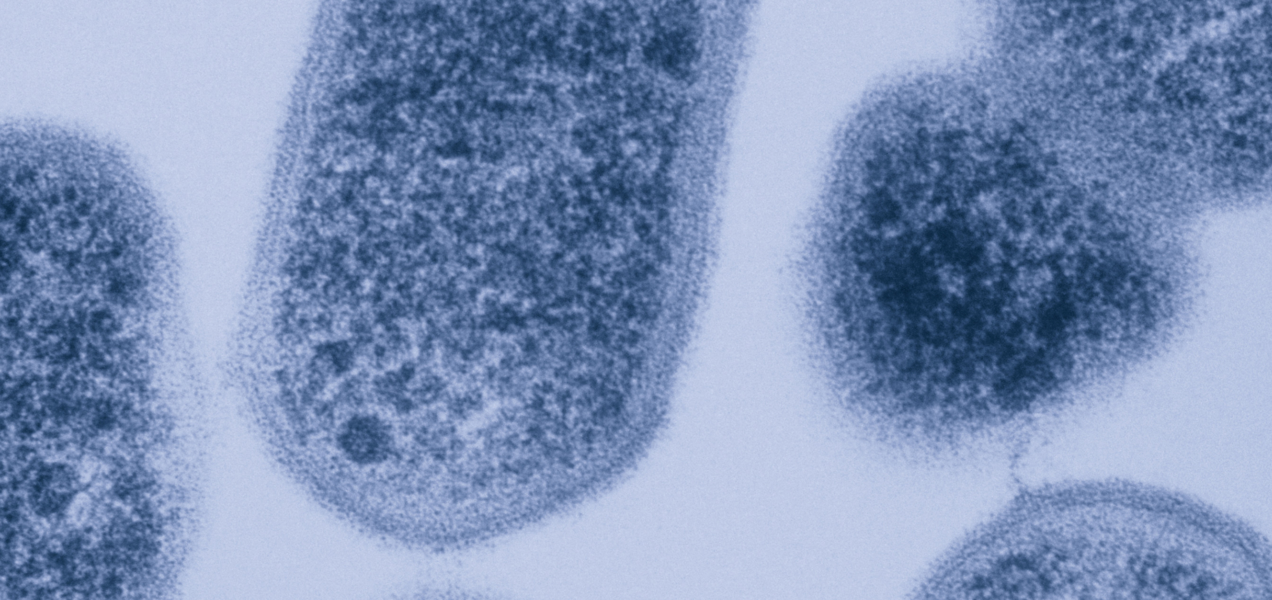 Bacterial Vaginosis: Getting to the Root of the Fickle Infection