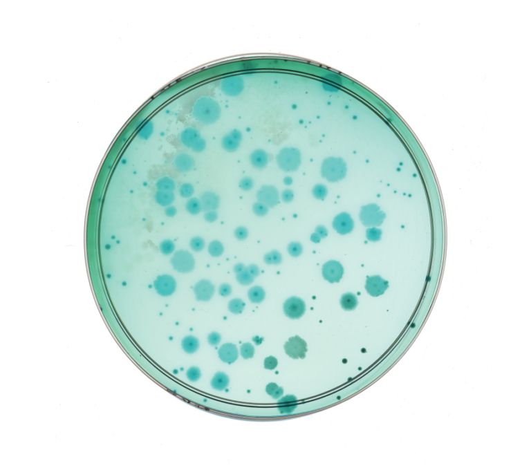 Petri dish with blue bacterial colonies growing on agar medium