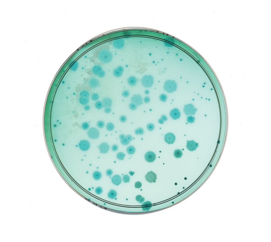Petri dish with blue bacterial colonies growing on agar medium
