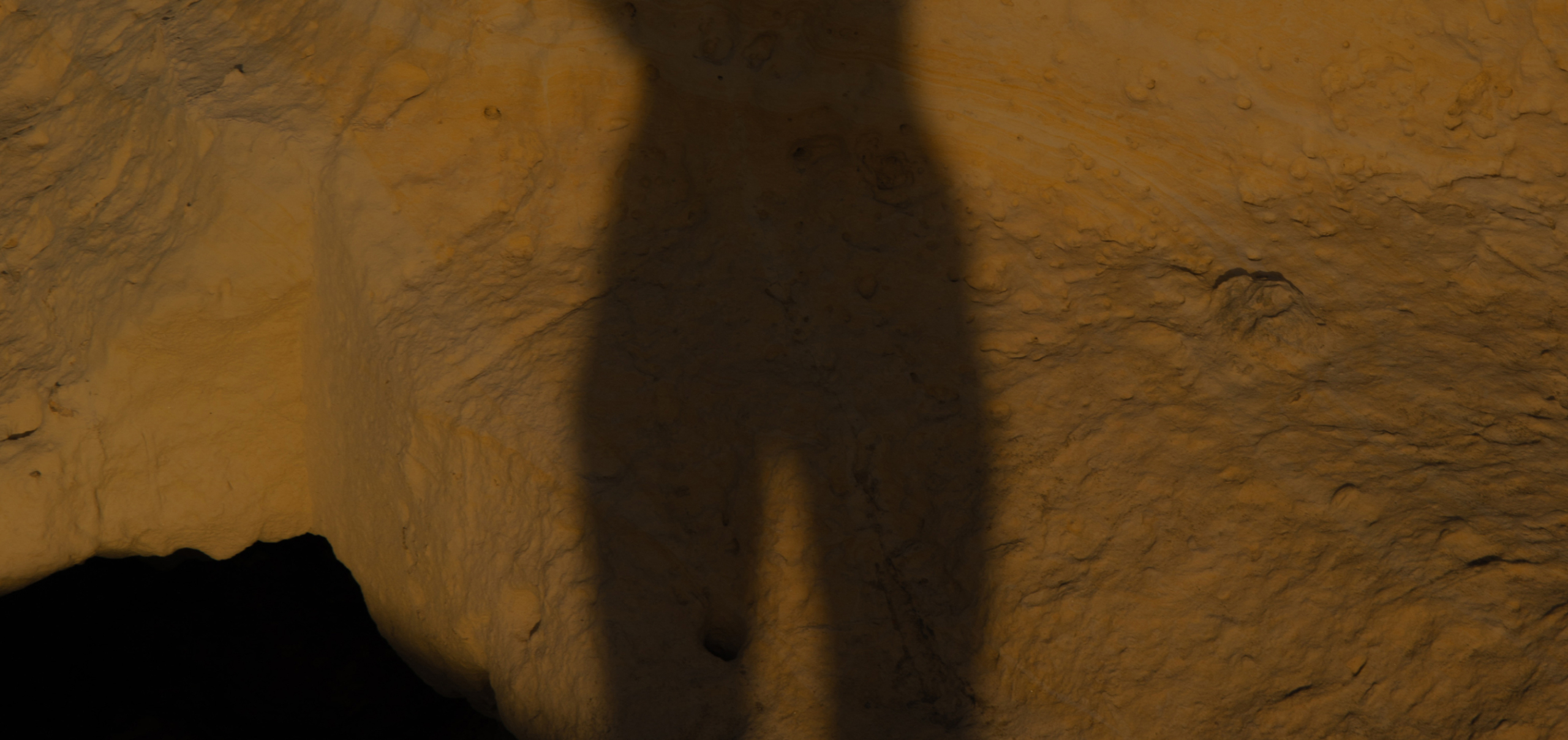 Vaginal Dryness, Demystified