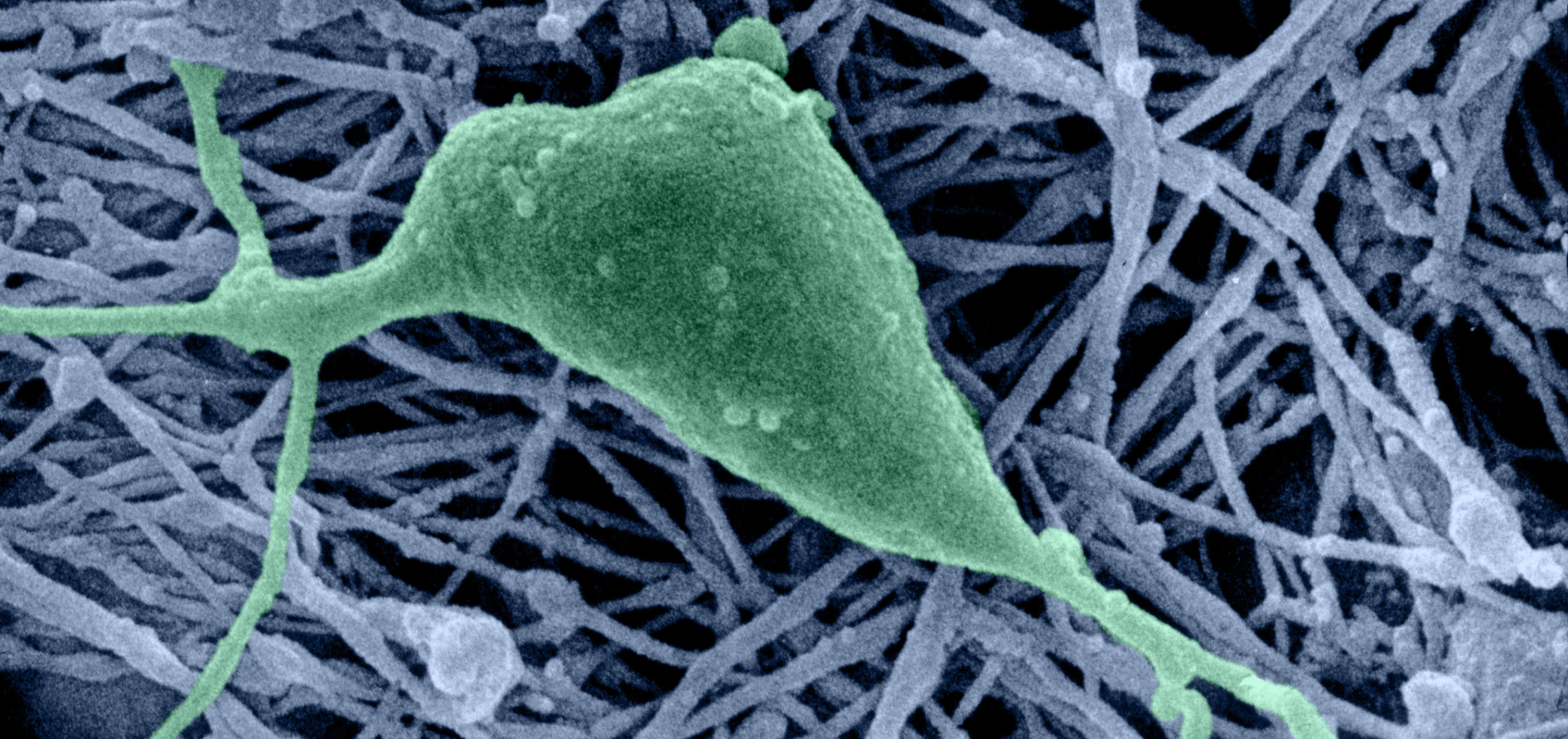 The Latest Research on the Gut-Brain Axis—And What It Means for You