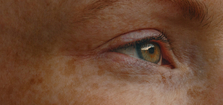 Close-up of a green eye with freckles on surrounding skin and visible eyelashes.