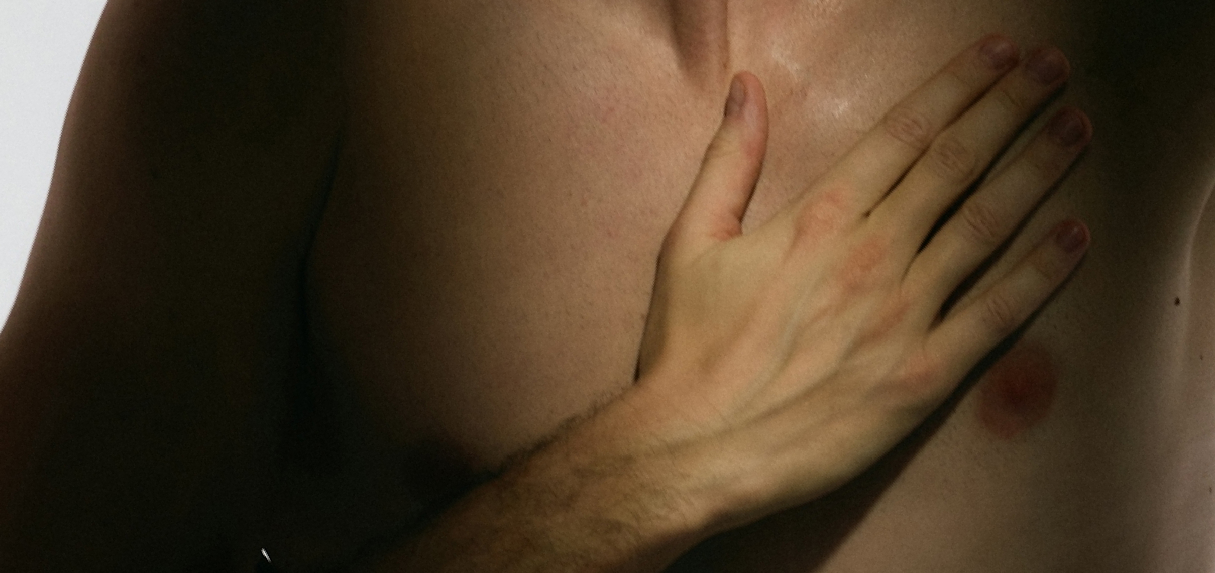 Probiotics for Cholesterol and Heart Health: A Science-Backed Guide