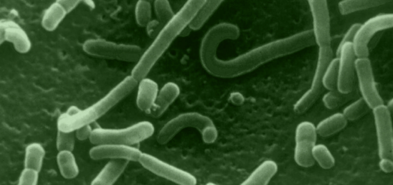 Beyond the Bathroom: Decoding the Signs of an Unhealthy Gut