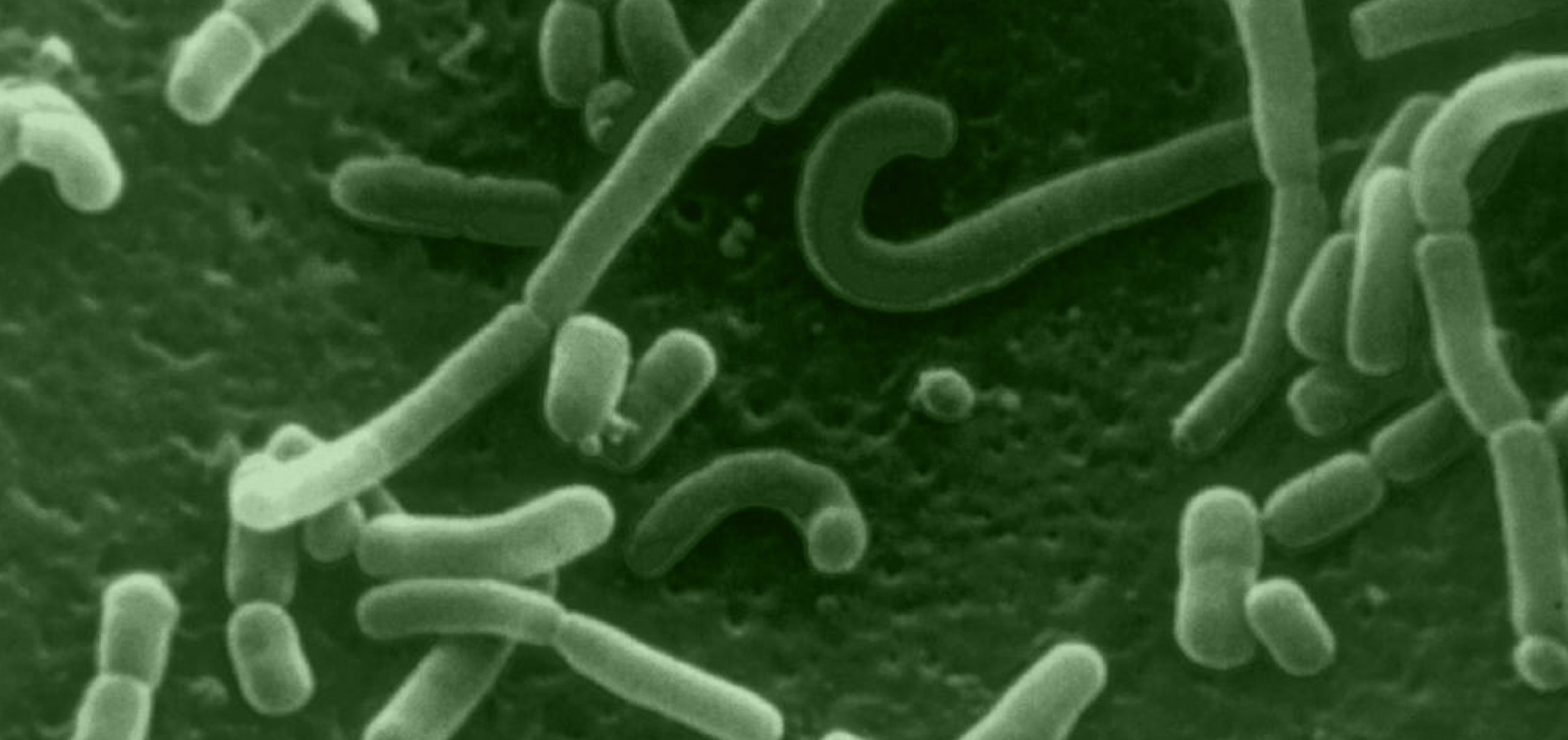 Beyond the Bathroom: Decoding the Signs of an Unhealthy Gut