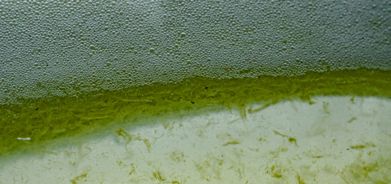 Prebiotics vs. Probiotics: The Science-Backed Guide to a Healthier Gut