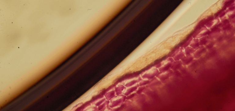 What is Butyrate? A Guide to the Gut’s Superstar Metabolite