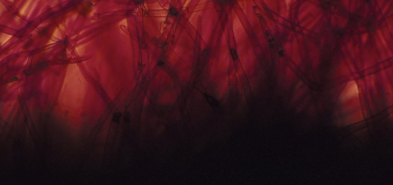 The Need to Feed: How to Increase Butyrate From the Inside Out