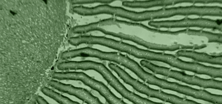 Probiotics for Parasites: What the Science Actually Says