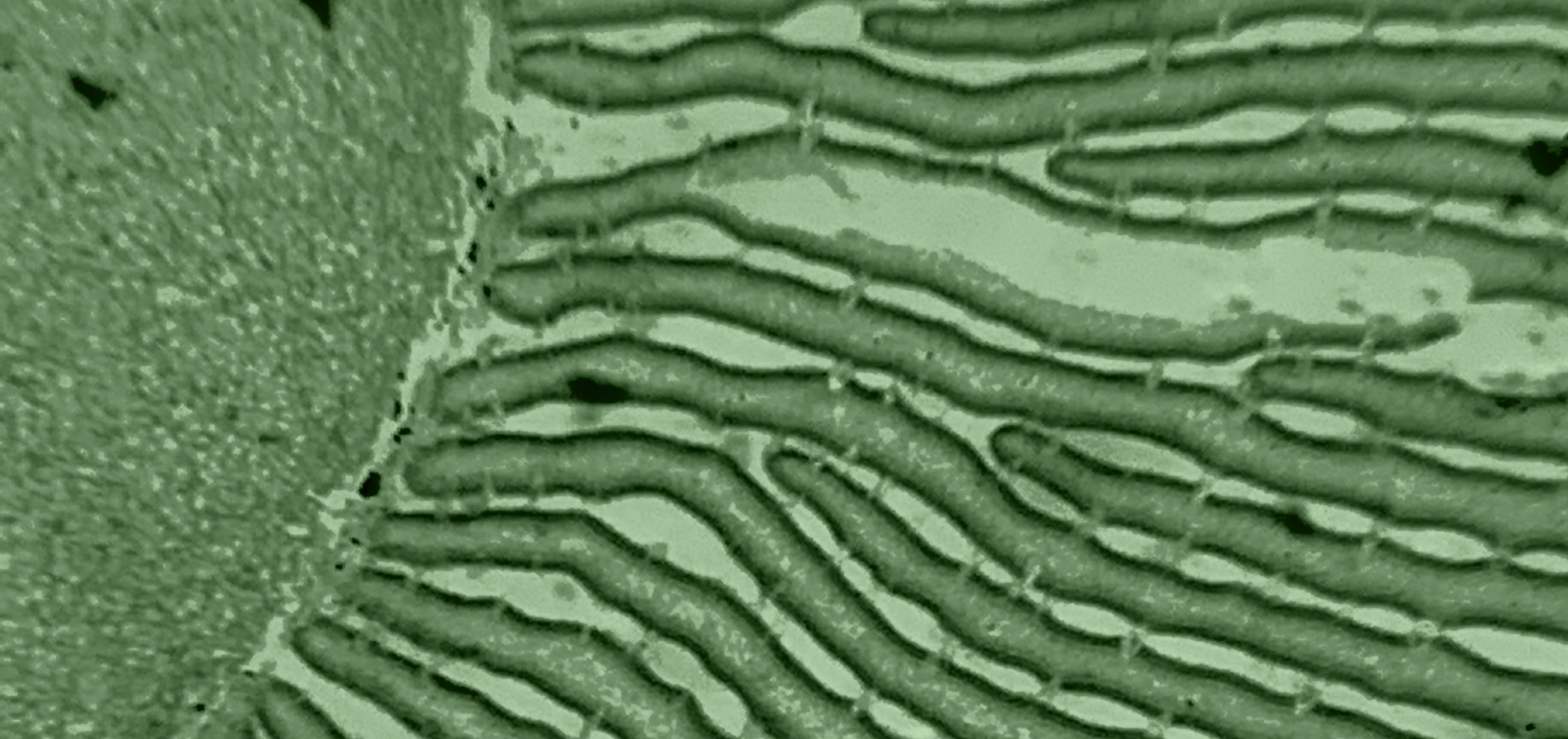 Probiotics for Parasites: What the Science Actually Says