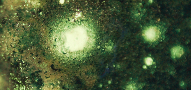 Your Gut’s Underrated MVP: Meet Bifidobacterium adolescentis