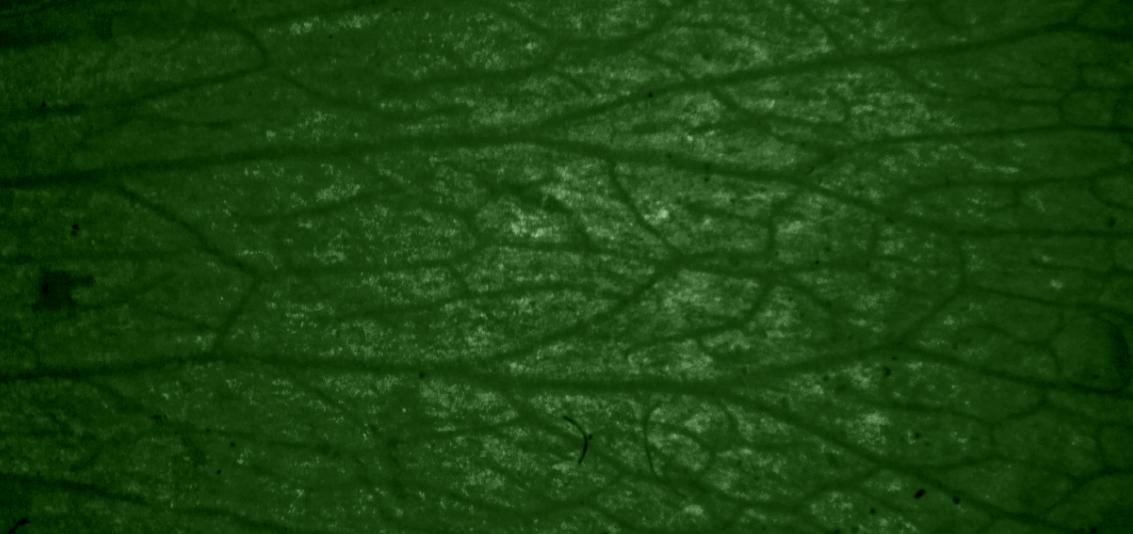 Lacticaseibacillus casei Decoded—Strains, Studies, and Practical Guidance